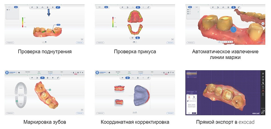 Интраоральный сканер Aoralscan L (LUX, полное ПО) - Фото 6